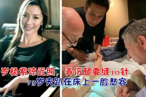 57歲楊紫瓊近照，弄傷腿要縫10針，73歲老公的表情趴在床上一臉愁容