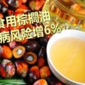 常食用棕櫚油　心臟病風險增6%