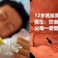 12歲男孩胃癌晚期，醫生：飲食3禁，父母一要管好孩子！