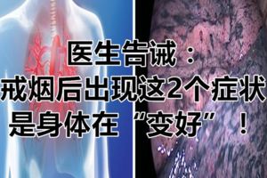 醫生告誡：戒煙後出現這2個症狀，是身體在「變好」！