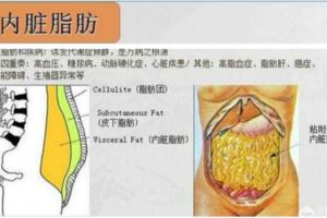 大腿粗的人應該如何瘦身？肥胖脂肪的分類：