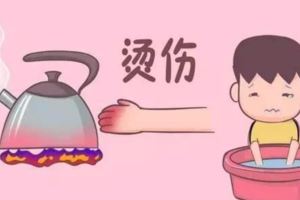 孩子燙傷後，最佳治療時間只有2分鐘，你知道該怎麼做嗎