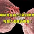 「癌症」竟在「前2年」就有徵兆！？每個人都應該看看，親友會感激你一輩子！