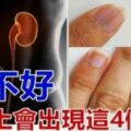 如果你「腎臟不好」你的指甲就會出現「這4個警告」很恐怖！不要不相信！