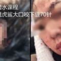 參加潛水課程女慘遭虎鯊大口咬下縫70針