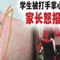 沒帶作業被打手掌心一下,學生家長找報館又報警