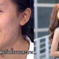 泰國醜女哭訴只想變正常人，改造完變「混血感天菜正妹」網友驚呆！