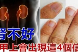 如果你「腎臟不好」你的指甲就會出現「這4個警告」很恐怖！不要不相信！