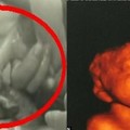 26歲準媽媽產檢後醫生說寶寶嚴重殘障！但超音波中胎兒不停微笑，媽媽決意不墮胎！可是寶寶出生後...