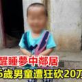 敲門吵醒睡夢中鄰居6歲男童遭狂砍20刀