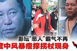 《古惑仔》李兆基2度中風爆瘦！消失3年零收入近況曝光