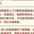 長了智齒，一定要拔嗎？