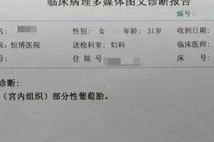 雅安恆博醫院案例報導：「葡萄胎」不是怪胎，而是妊娠滋養細胞疾病