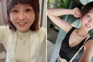 丟丟妹離婚後「瘦成一道閃電」！倒V臉被疑打肉毒抽脂　本人回應了