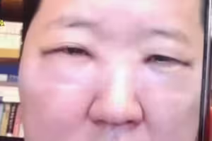 認了整形!韓男星術後「眼睛只剩一條縫」 慘認不出本人 認了整形!韓男星術後「眼睛只剩一條縫」 慘認不出本人