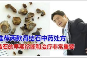 推薦兩款腎結石中藥處方腎結石的早期診斷和治療非常重要