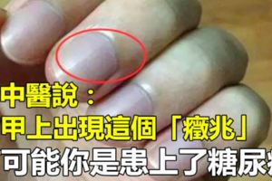 老中醫說：指甲上出現這個「癥兆」，有可能你是患上了糖尿病，再不看就晚了，看過都說準！