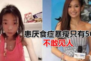 22歲嫁入豪門被人羨慕，如今患厭食症暴瘦只有50斤，不敢見人