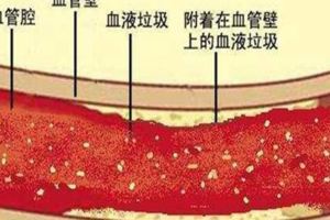 想長壽先清血管，常吃這些食物，血管幹淨人長壽