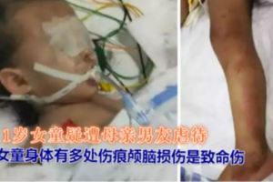 心痛！1歲女童疑遭母親男友虐待，生還可能為零！嫌疑人被刑拘！