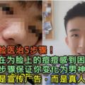 【「痘」花臉醫治5步驟！】還在為臉上的痘痘感到困擾？這5個步驟保證你變化為男神/女神！這不是宣傳廣告，而是真人試驗！