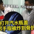 打開汽水瓶蓋　男手指被炸到骨折