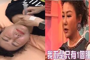 51歲藍心湄「腫瘤報告」震驚很多人，她在節目上坦言：「除了腫瘤外還有...」讓粉絲相當不捨！