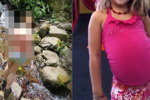 8歲小女孩意外掉進「高達9公尺」的樹洞卻毫髮無傷，把爸媽給嚇壞了！沒想到10天後，家人發現她的肚子竟然...