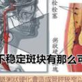 動脈不穩定斑塊有那麼可怕嗎？經常聽身邊人說起，頸動脈，冠狀動脈有不穩定斑塊