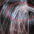 頭髮一白老十歲！這個「位置」長白髮說明這「器官」出問題了！每天這樣做10分鐘，恢復一頭黑髮，預防中風和痴呆！
