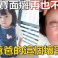 3歲寶寶面癱再也不能笑，竟是因為爸爸對她做了這件事！