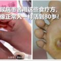 糖尿病專家：糖尿病患者用這些食療方，可像正常人一樣活到80歲！