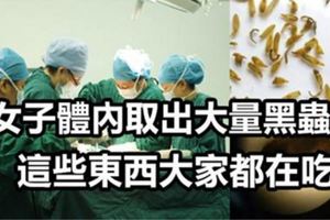 女子體內取出大量黑蟲，與「這個愛好」有關！沒想到「這些東西」大家都在吃！