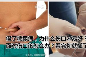 得了糖尿病，為什麼傷口不易好？面對傷口該怎麼辦？看完你就懂了