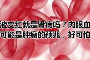 尿液變紅就是腎病嗎？肉眼血尿也可能是腫瘤的預兆，好可怕！