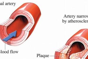 血管幹淨，人不老，那麼如何清洗血管？吃什麼對血管好？