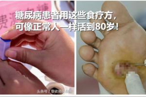 糖尿病專家：糖尿病患者用這些食療方，可像正常人一樣活到80歲！