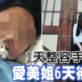 1天整容手術3次愛美姐6天後身亡