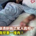 婦科醫生崩潰辭職之驚人真相：引產胎兒竟捏著一塊肉！