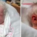 小寶寶出生一頭白發，醫生說這不是白化病，白頭發背後的現象