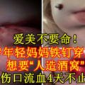 愛美不要命！17歲年輕媽媽鐵釘穿雙頰想要「人造酒窩」傷口流血4天不止【內附影片】