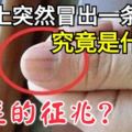 指甲上突然冒出一條黑線究竟是什麼？癌症的徵兆？