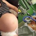 37歲產婦誕下龍鳳胎，丈夫狠心拔掉呼吸機，醫生卻為丈夫點讚！