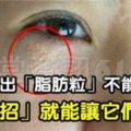 眼角總是長「脂肪粒」？別急著用手擠，教你「4招」簡單方法，眼周更光滑細膩！