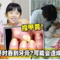 小孩刷牙時吞到牙膏？可能會造成指甲黃！