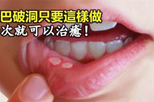 口腔潰瘍雖不大卻痛到讓人受不了，原來只要「這樣做」就能快速痊癒！