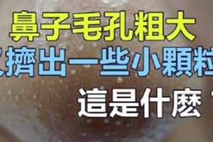 鼻子「毛孔粗大」但是又能擠出一顆顆「小顆粒」，這是什麼？教你幾個小妙招，皮膚光滑不油膩！