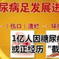 1億人因糖尿病面臨或正經歷「截肢」，你可了解糖尿病足的嚴重性