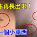 脖子上突然長了「肉粒」，這個到底是什麼東西？只需「1個小東西」，就能讓「肉粒」徹底脫落！