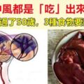 醫生提醒：過了50歲，不想中風，3種食物要儘量遠離，多做2件事，腦血管越來越乾淨